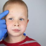 Pox rash conditions rashes chickenpox
