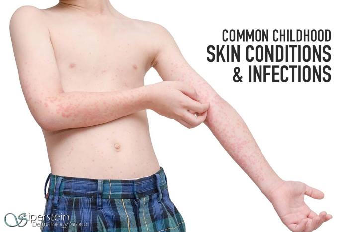 Skin problems children poster conditions nz infections boils kidshealth pdf impetigo 5mb following information